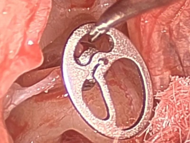 Dr. André Maranhão Especialista em Saúde Auditiva e Otologia em Florianópolis