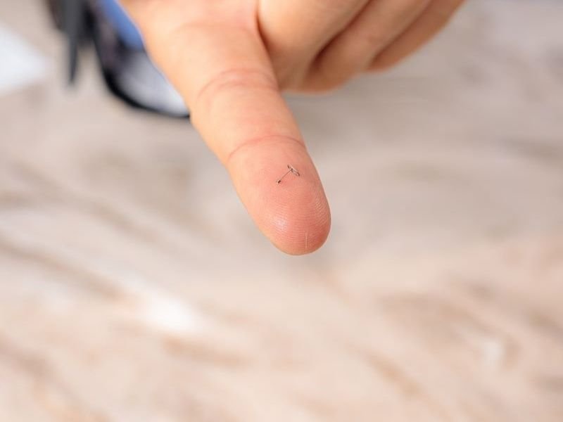 Mastoidectomia com Abordagem Minimamente Invasiva em Florianópolis