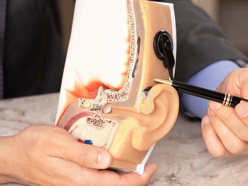 Procedimento de Estapedotomia em Pacientes com Otosclerose em Florianópolis