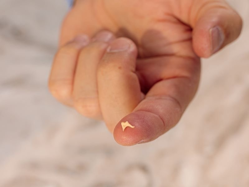 Timpanoplastia em Crianças Benefícios e Precauções em Florianópolis