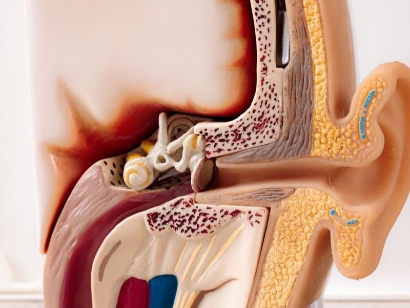 Estapedotomia em Barreiras